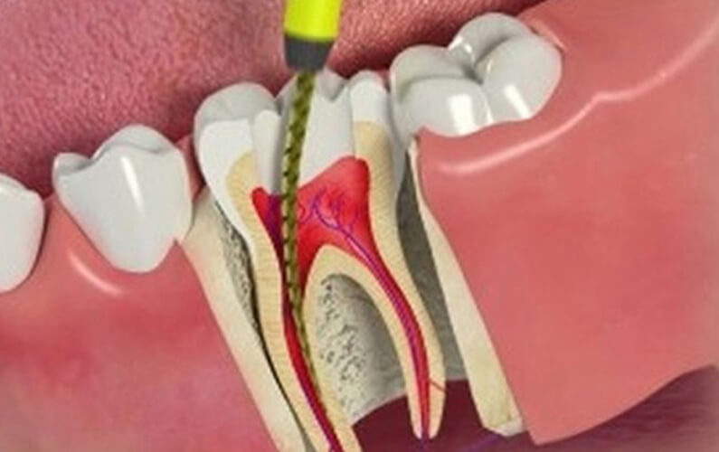 FAIR MULTI SPECIALITY DENTAL CLINIC ORKKATTERI