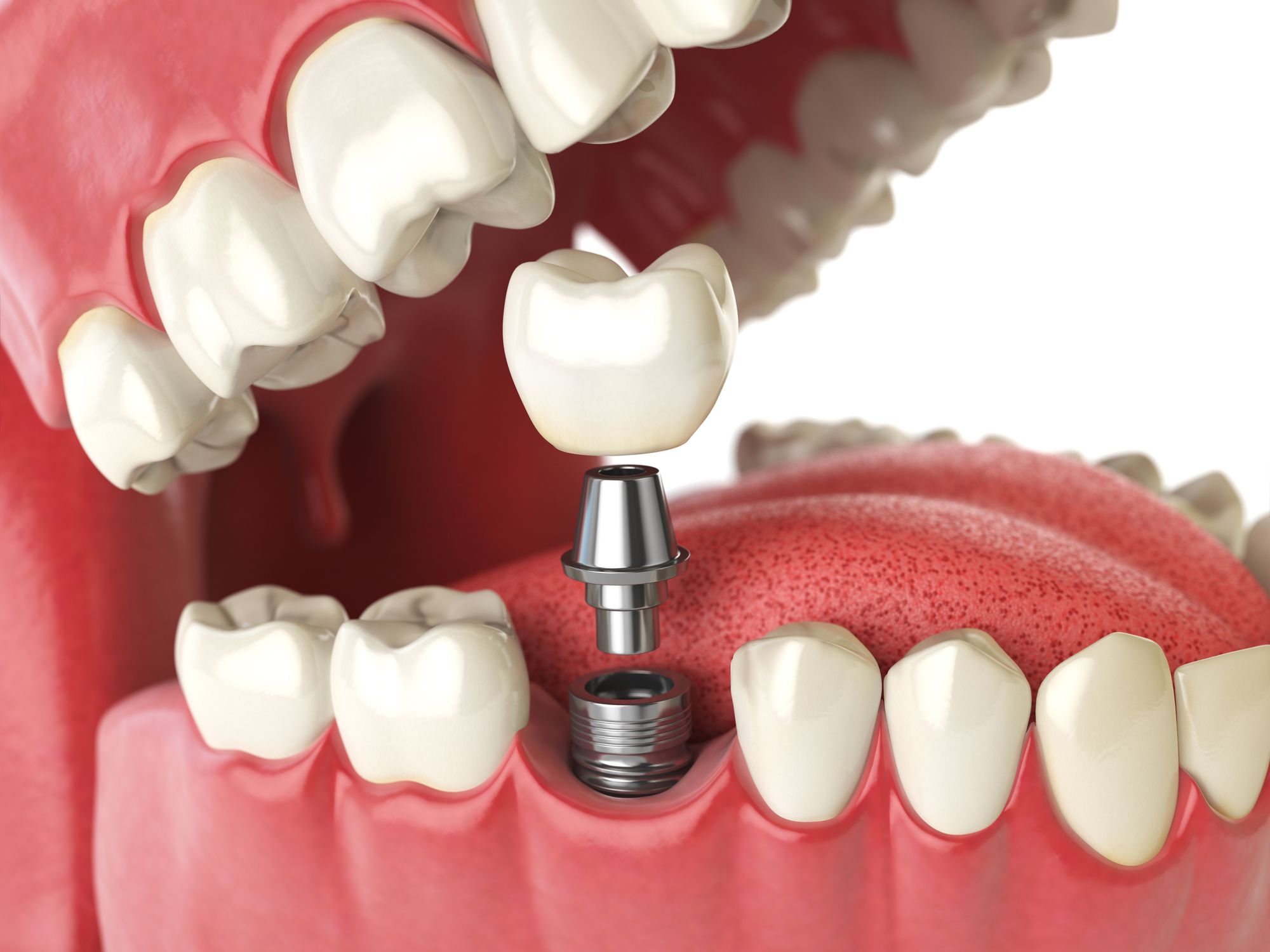 FAIR MULTI SPECIALITY DENTAL CLINIC ORKKATTERI